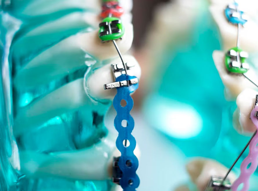 Neuro Spine Surgery