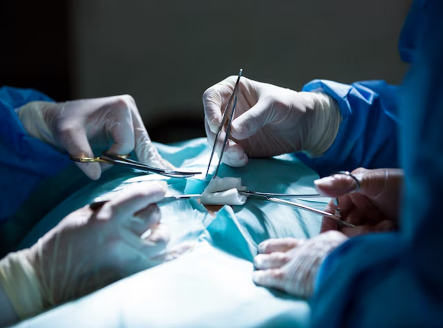 Vascular Surgery